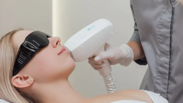 LaserHairRemoval-Face_Chin