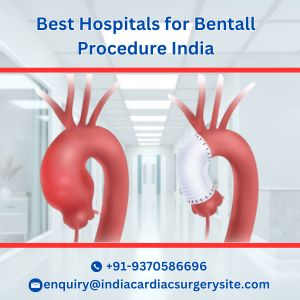 Best-Hospitals-for-Bentall-Procedure-India
